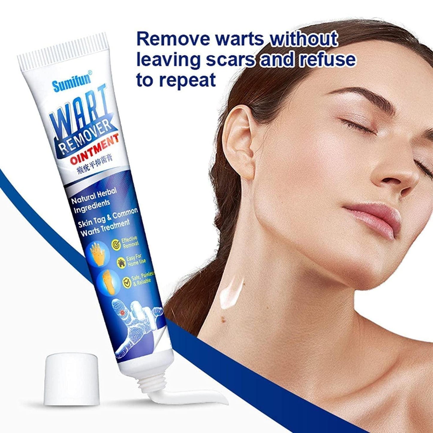 Warts Remover Cream Extract Skin